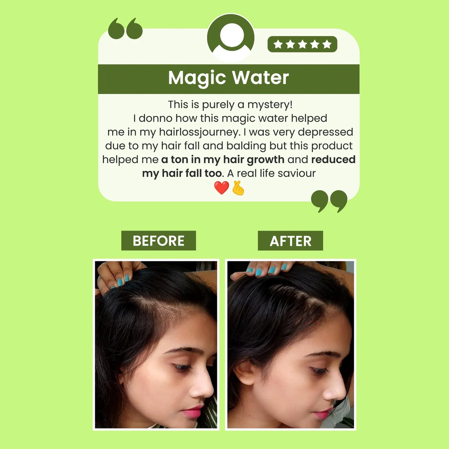 Rosemary Water, Hair Spray For Regrowth (Pack of 3)